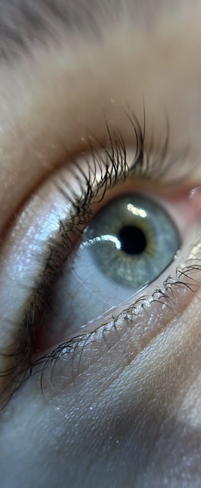 Lashes before treatment