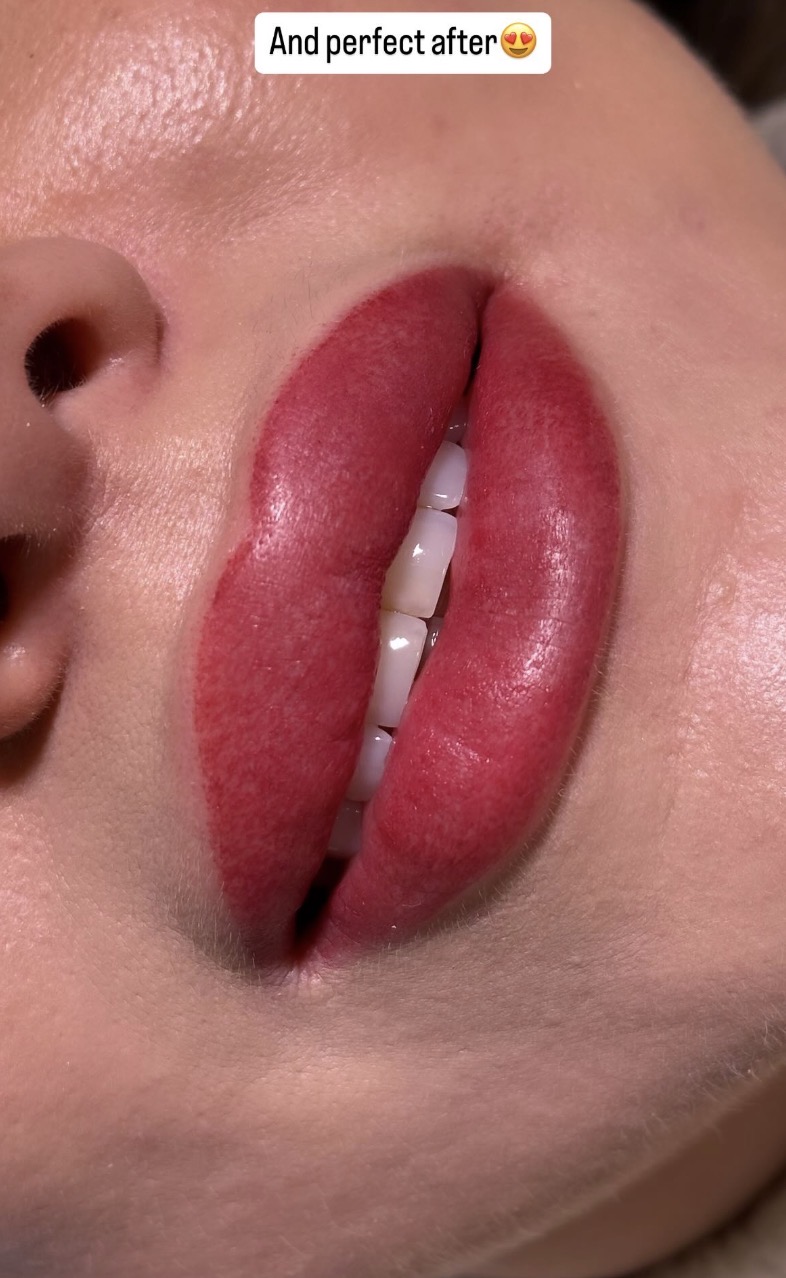 Permanent Lip Blush